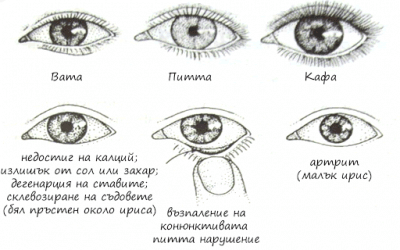Диагностика по очите